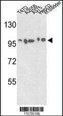 Anti-ACTN4 Rabbit Polyclonal Antibody