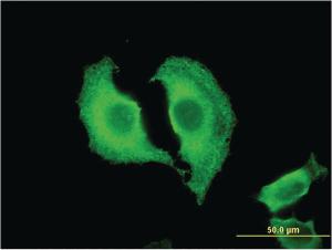 Anti-CTRB1 Mouse Monoclonal Antibody [clone: 3C8]