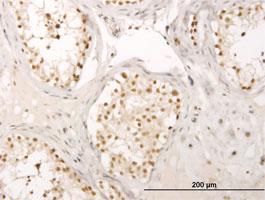 Anti-MED17 Mouse Monoclonal Antibody [clone: 4D4]