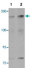 Anti-ANAPC1 Rabbit Polyclonal Antibody