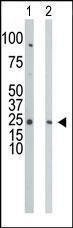 Anti-UCK1 Rabbit Polyclonal Antibody (APC (Allophycocyanin))