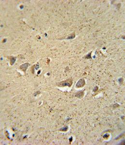 Anti-SCN1B Rabbit Polyclonal Antibody (PE (Phycoerythrin))