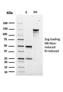 SDS-PAGE analysis of Anti-SOX9 Antibody [rSOX9/2288] under non-reduced and reduced conditions; showing intact IgG and intact heavy and light chains, respectively. SDS-PAGE analysis confirms the integrity and purity of the antibody