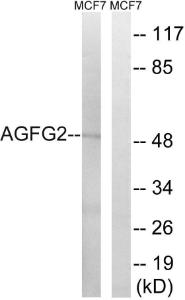 Anti-AGFG2 antibody