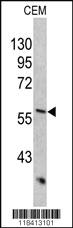 Anti-KRT10 Rabbit Polyclonal Antibody