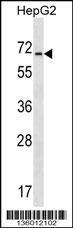 Anti-ASIC4 Rabbit Polyclonal Antibody (FITC (Fluorescein Isothiocyanate))