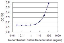 Anti-CTRB1 Mouse Monoclonal Antibody [clone: 3C8]