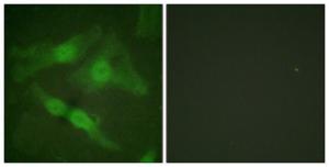 Immunofluorescence analysis of HeLa cells using Anti-PKC zeta (phospho Thr410) Antibody. The right hand panel represents a negative control, where the antibody was pre-incubated with the immunising peptide