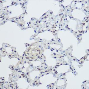 Antibody anti-XRCC1 100 µl