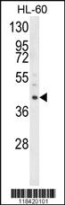 Anti-LRG1 Rabbit Polyclonal Antibody