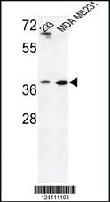 Anti-MAT2B Rabbit Polyclonal Antibody