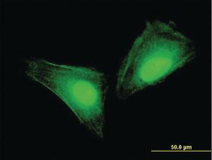 Anti-S100 A11 Mouse Monoclonal Antibody [clone: 2F4]