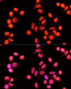 Antibody anti-XRCC1 100 µl