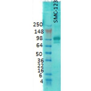 Western blot analysis of rat brain membrane lysate showing detection of PSD95 protein using Anti-PSD95 Antibody [7E3] (A304702) at 1:1000