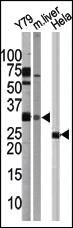 Anti-ATG5 Rabbit Polyclonal Antibody