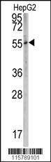 Anti-CYP2W1 Rabbit Polyclonal Antibody