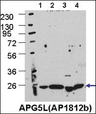 Anti-ATG5 Rabbit Polyclonal Antibody