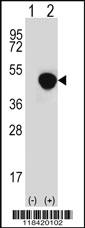 Anti-LRG1 Rabbit Polyclonal Antibody