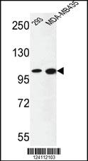 Anti-NCOA7 Rabbit Polyclonal Antibody