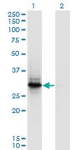 Anti-FYCO1 Mouse Polyclonal Antibody