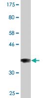 Anti-COG3 Mouse Monoclonal Antibody [clone: 2G7]