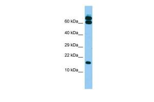 Anti-B9D2 Rabbit Polyclonal Antibody