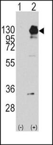 Anti-PDGFRA Rabbit Polyclonal Antibody (APC (Allophycocyanin))