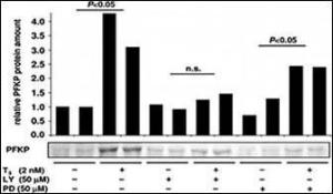 Anti-PFKP Rabbit Polyclonal Antibody