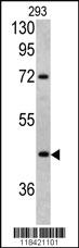 Anti-LRG1 Rabbit Polyclonal Antibody