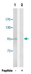 Anti-DLGAP5 Rabbit Polyclonal Antibody