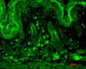 Immunohistochemistry analysis of mouse backskin, fixed in Bouin's fixative solution and paraffin-embedded