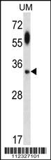 Anti-ATG5 Rabbit Polyclonal Antibody