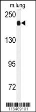 Anti-ACE Rabbit Polyclonal Antibody