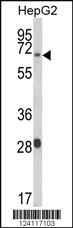 Anti-DNAJA3 Rabbit Polyclonal Antibody