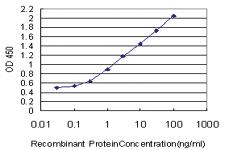 Anti-S100 A11 Mouse Monoclonal Antibody [clone: 2F4]