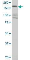 Anti-EIF4G3 Mouse Monoclonal Antibody [clone: 1B4]