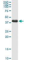 Anti-PDLIM2 Polyclonal Antibody Pair