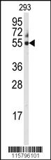 Anti-NOS2 Rabbit Polyclonal Antibody