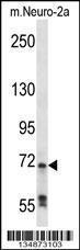 Anti-RAF1 Rabbit Polyclonal Antibody (AP (Alkaline Phosphatase))