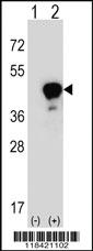 Anti-LRG1 Rabbit Polyclonal Antibody