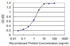 Anti-S100 A11 Mouse Monoclonal Antibody [clone: 1B12]