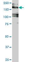 Anti-EIF4G3 Mouse Monoclonal Antibody [clone: 1D7]