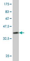 Anti-RIPK4 Mouse Monoclonal Antibody [clone: 4H5]