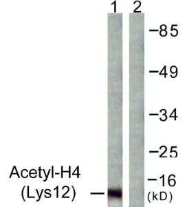 Antibody anti-histone H4 acetyl LYS12