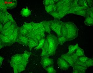 Immunocytochemistry/Immunofluorescence analysis of human HaCaT cells, fixed in cold 100% methanol for 10 minutes at -20°C, using Anti-PSD95 Antibody [7E3] (A304702), at 1:100 for 1 hour at room temperature