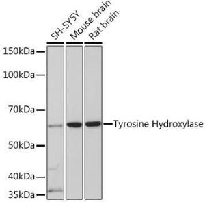 Anti-Tyrosine Hydroxylase Rabbit Monoclonal Antibody [clone: ARC1184]