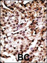 Anti-ATG7 Rabbit Polyclonal Antibody