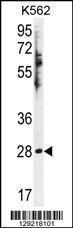 Anti-HSD11B1L Rabbit Polyclonal Antibody (HRP (Horseradish Peroxidase))