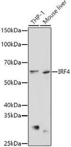 Western blot analysis of extracts of various cell lines, using Anti-MUM1 Antibody (A11160) at 1:1,000 dilution. The secondary antibody was Goat Anti-Rabbit IgG H&L Antibody (HRP) at 1:10,000 dilution.