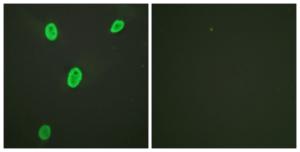 Antibody anti-histone H4 acetyl LYS12